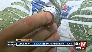 CDC says Hepatitis A cases have increased nearly 300%