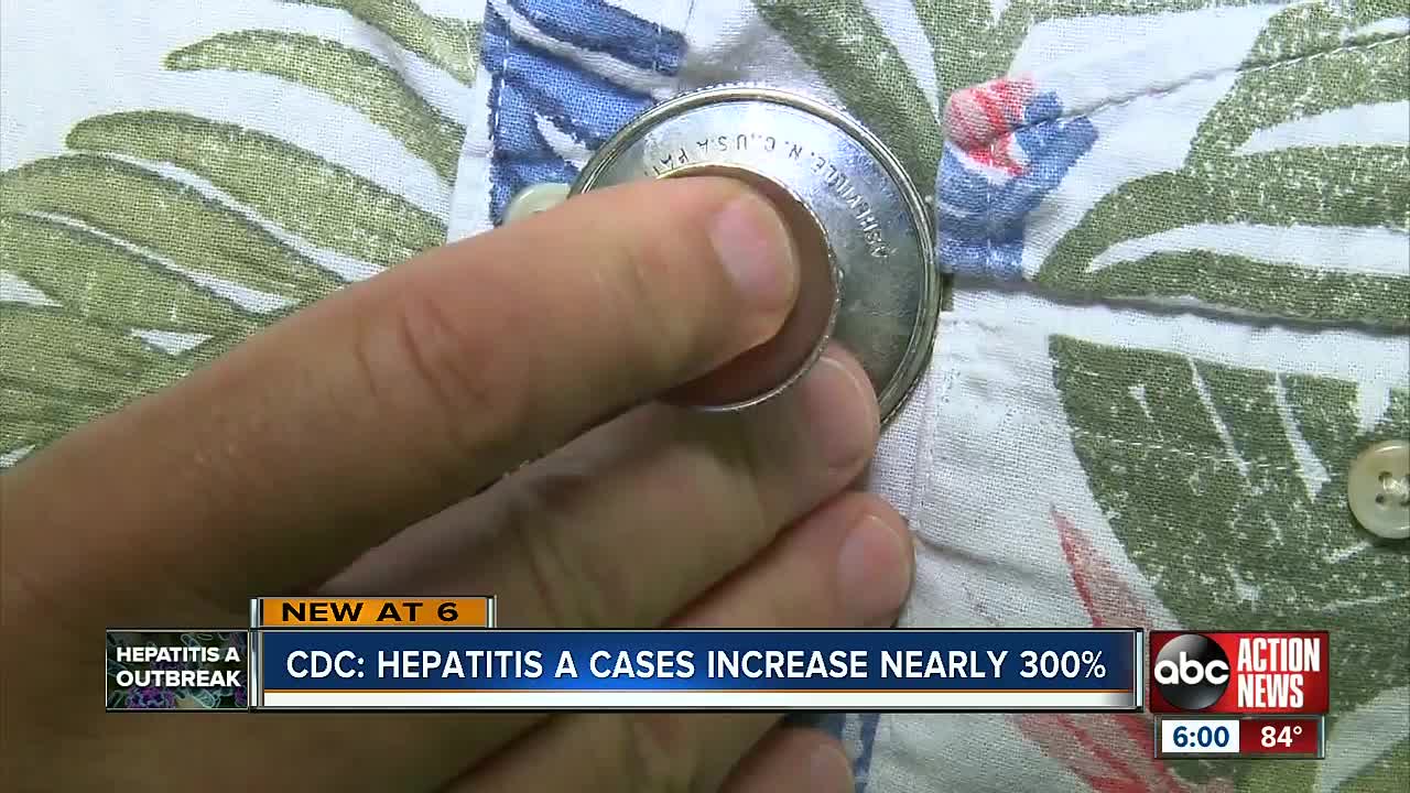 CDC says Hepatitis A cases have increased nearly 300%