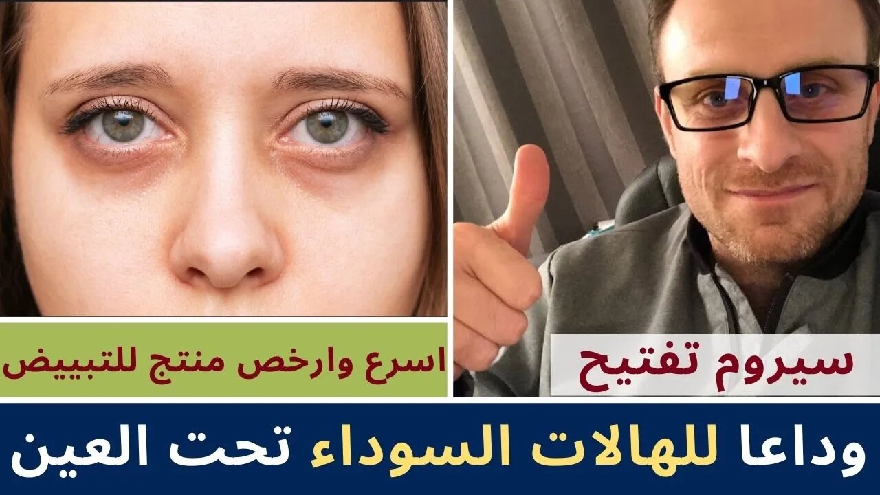 سيروم الخيار الرهيب لتبيض الوجه في ربع ساعة وقولي وداعا للخطوط والتجاعيد والهلات السوداء تحت العين