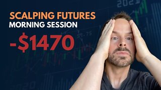 WATCH ME TRADE | -$1470 LOSS | DAY TRADING Nasdaq Futures Trading - Scalping Day Trading