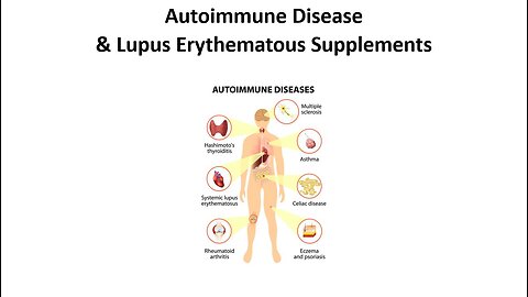 Lupus Erythematous - Autoimmune Disease Supplements