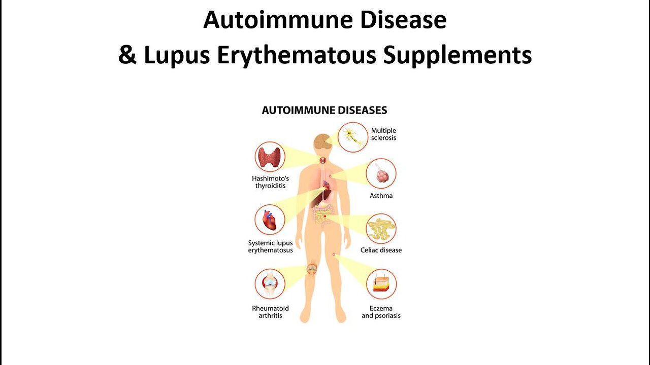 Lupus Erythematous - Autoimmune Disease Supplements