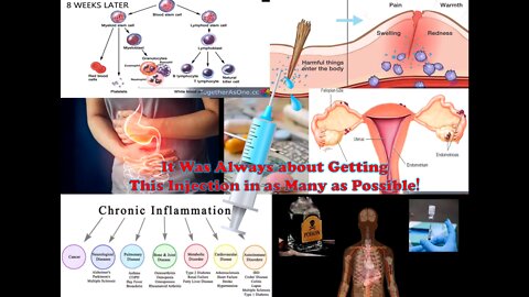 (Reshared) Hearken A Nurse on What the Injection Does, No Immune System & Endometriosis