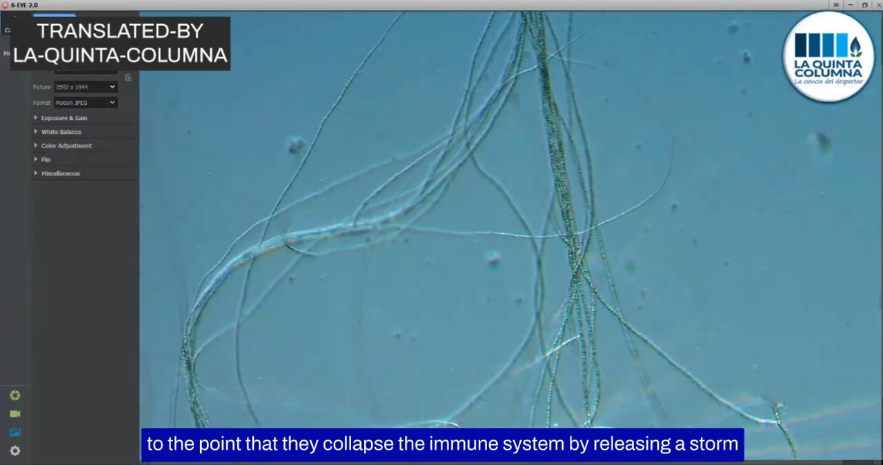 🇬🇧🇺🇸 #English - Optical microscopic analysis of a Pfizer vial. This is not a vaccine.