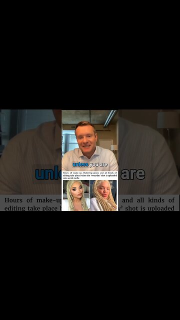 Leave Social Media: You Won't Miss It that much unless you are NARCISSIST #shortvideo