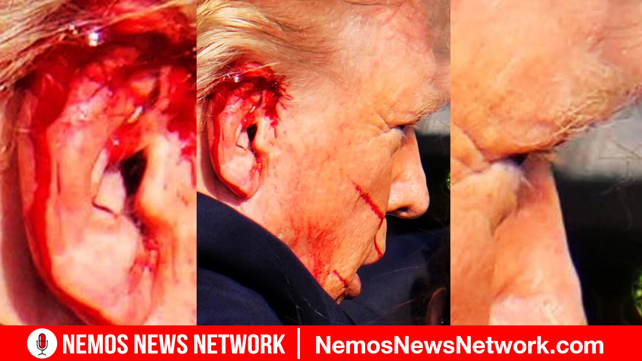 PROOF TRUMP FAKED THE SHOOTING!?! BY DUSTIN NEMOS