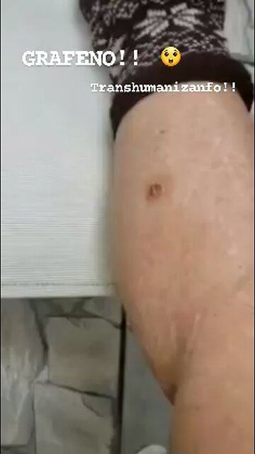 O grafeno está em tudo que ingerimos ?