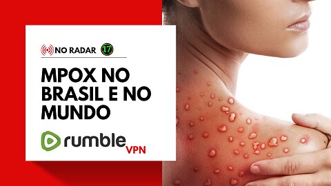 NO RADAR: Mpox no Brasil e no Mundo