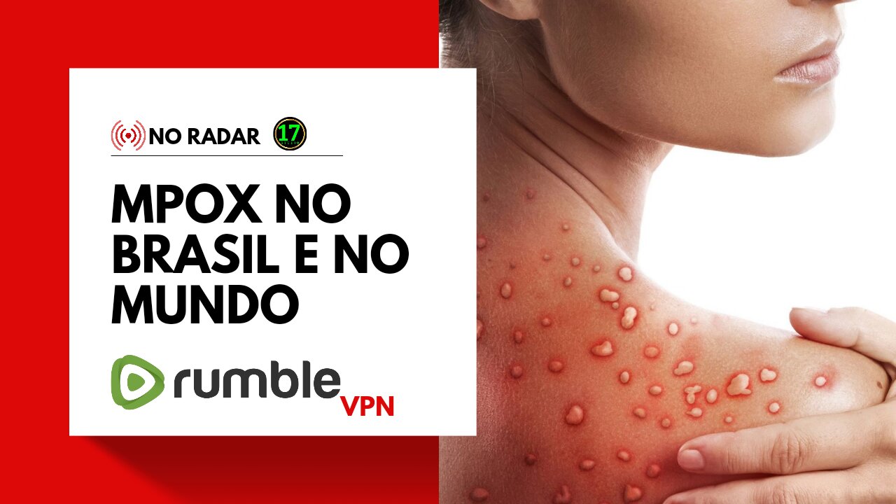 NO RADAR: Mpox no Brasil e no Mundo