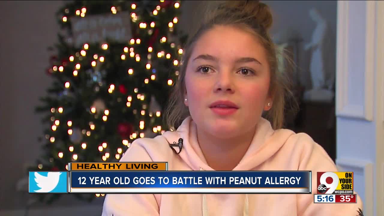 12-year-old battles peanut allergy with experimental treatment