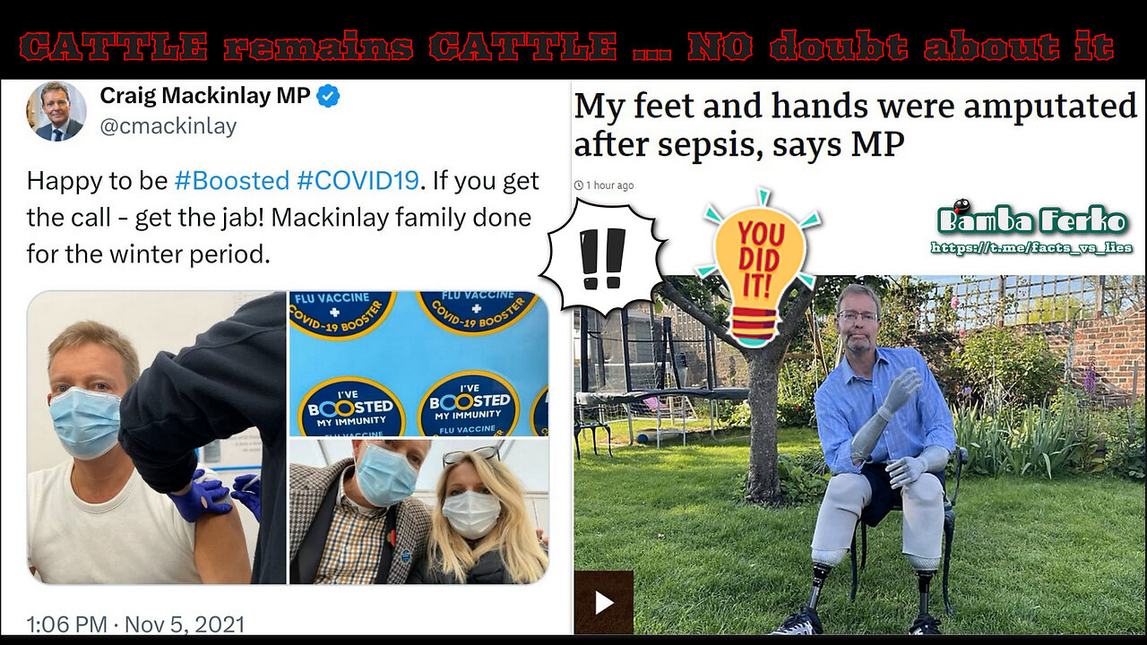 VAxXxED AND BOOSTED MP Craig Mackinlay ... Now A QUADRUPLE Amputee [Karma is a BITCH, you know!]