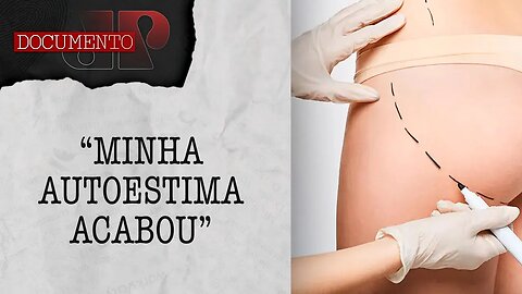 Como uma cirurgia de silicone no glúteo colocou vida de paciente em risco? | DOCUMENTO JP