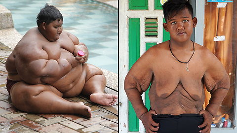 World’s Heaviest Kid Loses 220lbs | TRULY