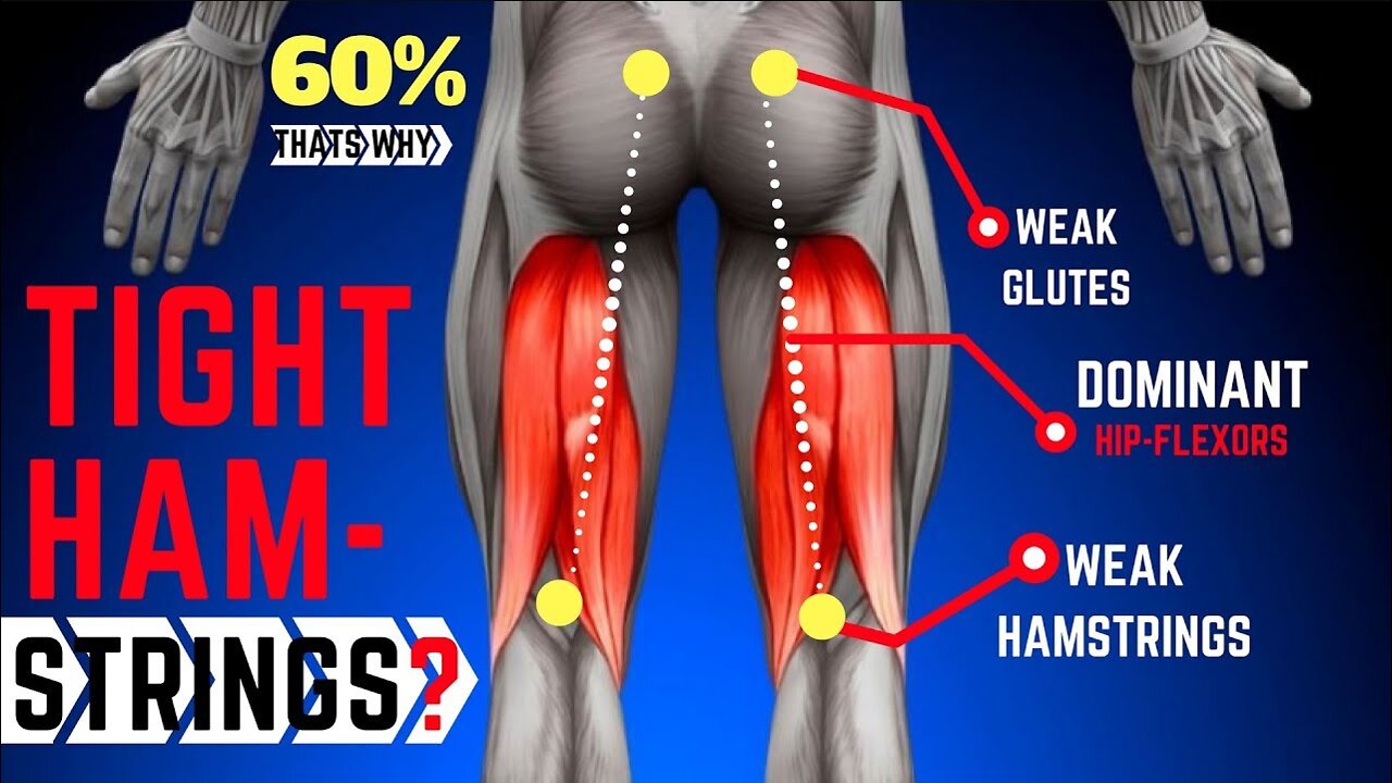 Why Your Hamstrings Are Always Tight | Anterior Pelvic Tilt