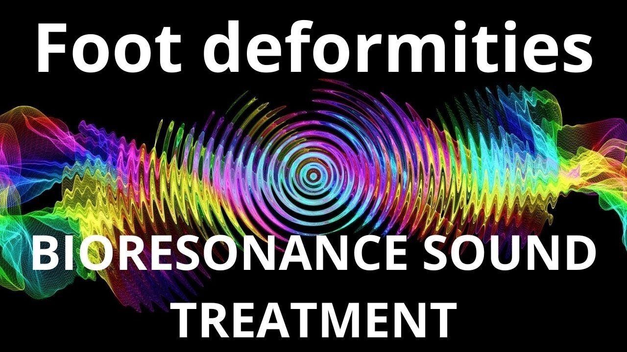 Foot deformities _ Bioresonance Sound Therapy _ Sounds of Nature