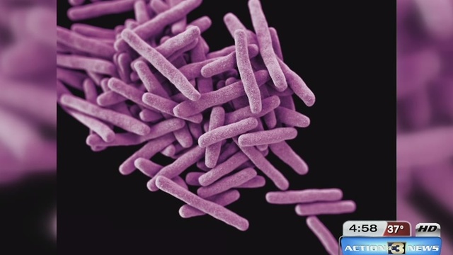 Are you at risk of getting Tuberculosis?