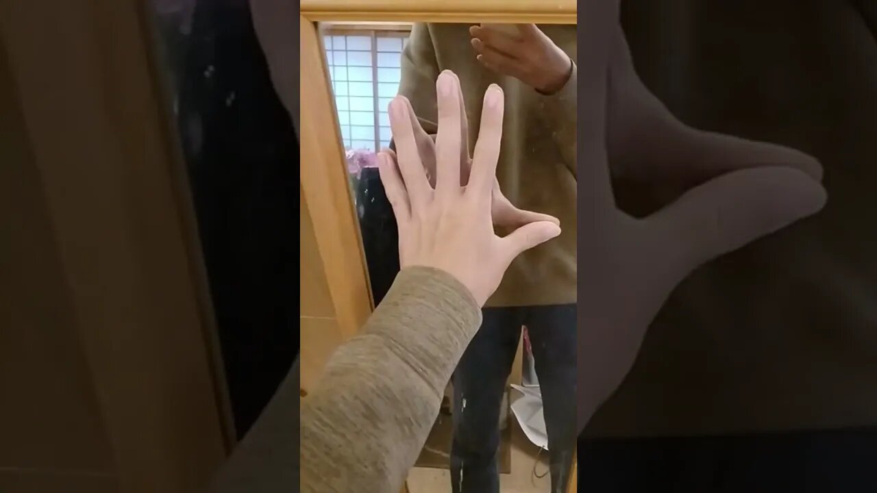 腕が取れました