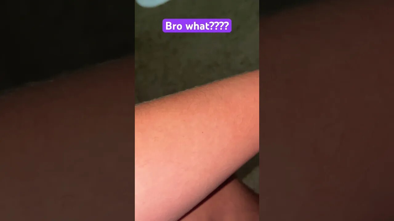 Wow, do you have that freckle on your arm?