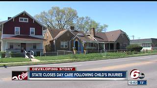 State closes Indianapolis day care after 1-year-old seriously hurt