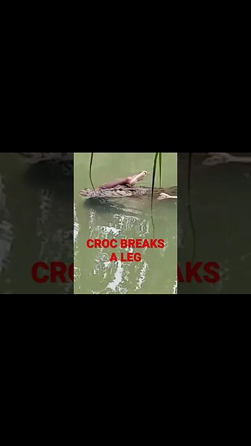 Foot In Mouth - Croc Bites a Human Leg