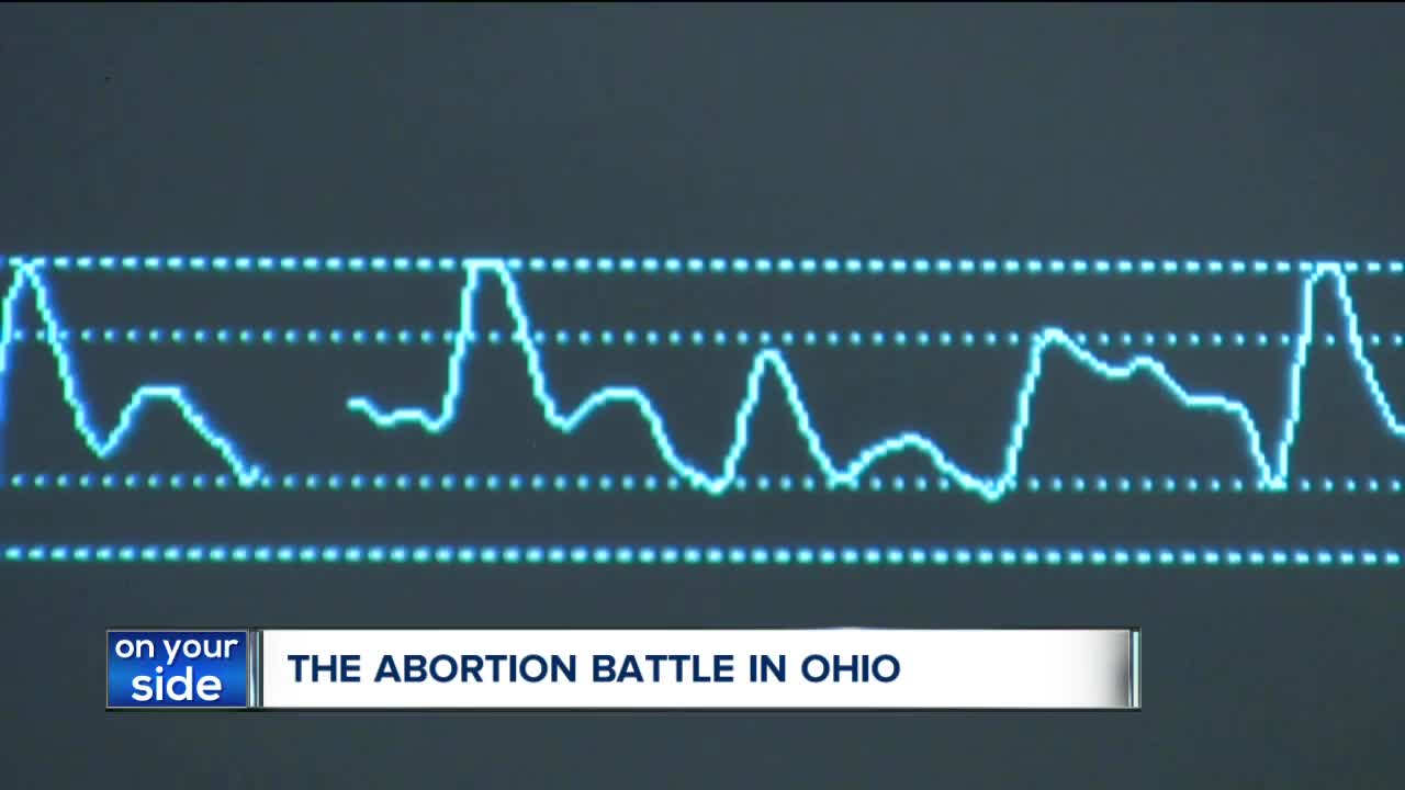 Ohio cuts funding for Planned Parenthood