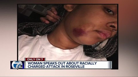 Metro Detroit woman beaten in parking lot, she says because she's black
