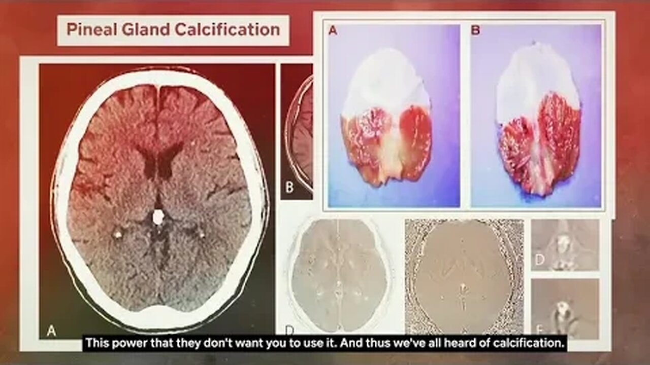 Your Pineal Gland Is Stimulated When You Close Your Eyes.