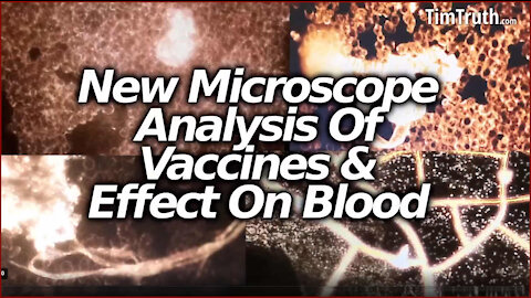 VAXXED Patient Blood Examined Under Microscope With, Horrific Findings by German Scientists