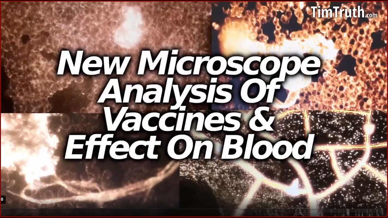 VAXXED Patient Blood Examined Under Microscope With, Horrific Findings by German Scientists