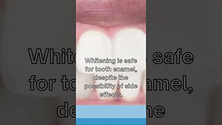 Do teeth whiten damage your teeth?