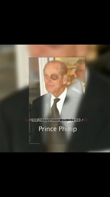 Adrenochrome and VRIL - DRONED VIA THE EYE LEADS TO THE BLACK EYE