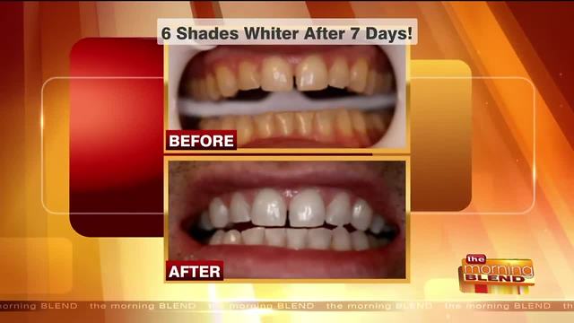 Start the New Year with a New Smile