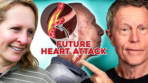 CIMT Expert: This Test Can Predict 98% of Heart Attacks