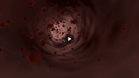 Montage