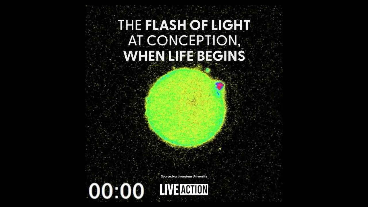 The flash of light when a child's life starts!