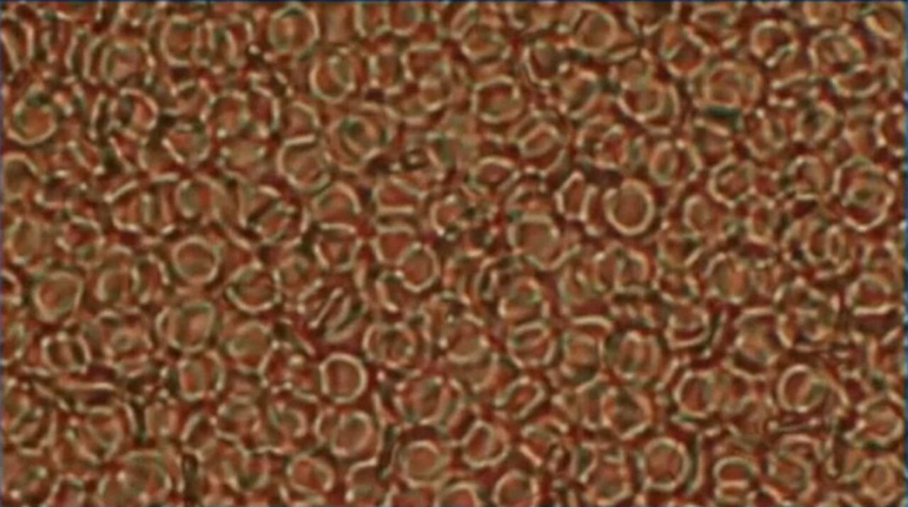 Microscopic images of the deoxygenation of blood with vaccine