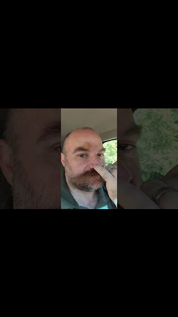 Getting cut on some more? Dermatologist Skin cancer?