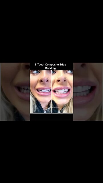 Dental And Teeth Hygiene