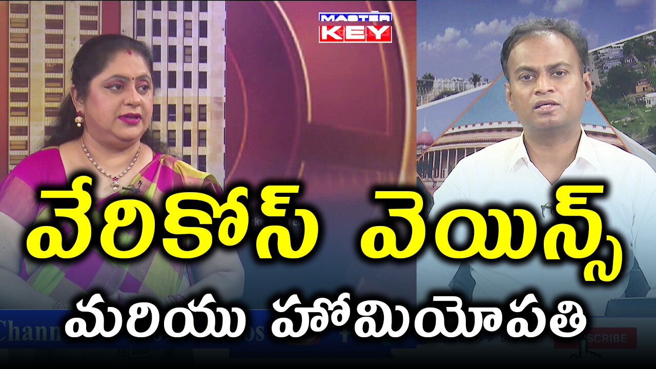 వేరికోస్ వెయిన్స్ మరియు హోమియోపతి చికిత్స . | Dr. Bharadwaz | Homeopathy, Medicine & Surgery