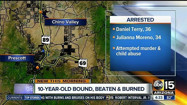 Child found bound, beaten and burned