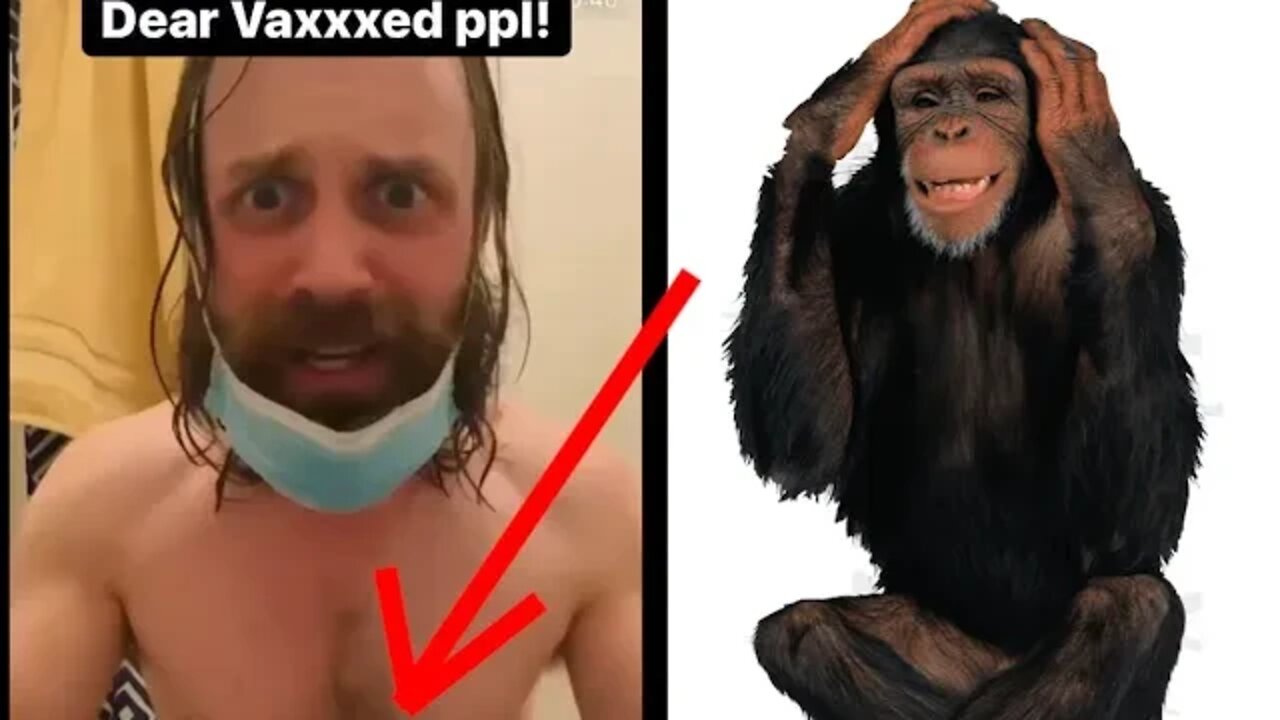 Man finds bizarre cure for Monkeypox!