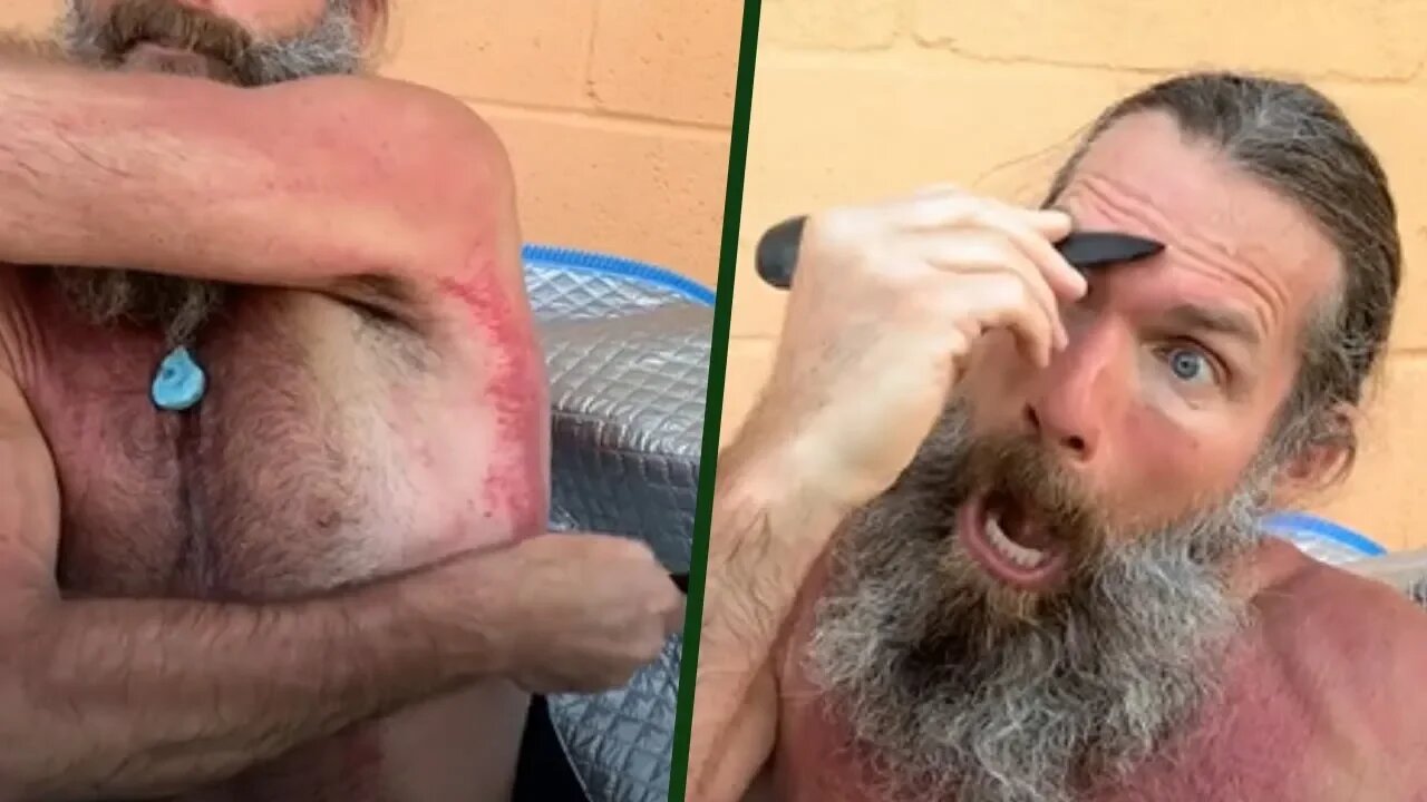 This Ancient Chinese Healing Method Holistically Fixes Joint Pain and Relieves Stress