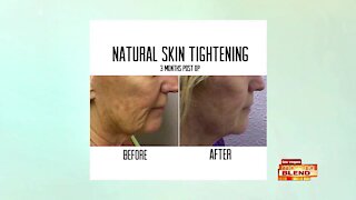 Tighten Your Skin In Minutes