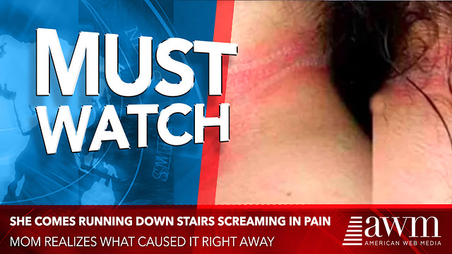 She Comes Running Down Stairs Screaming In Pain, Mom Realizes What Caused It Right Away