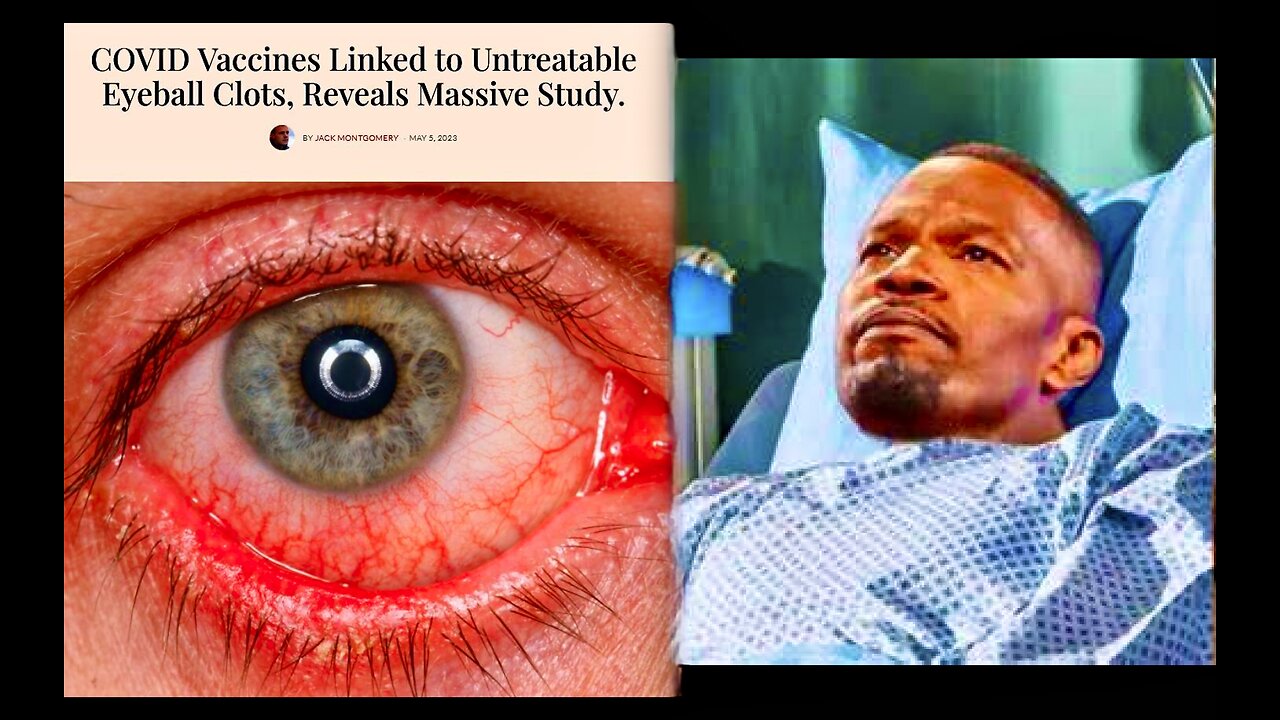 Jamie Foxx Exposes Covid Vax Linked To Untreatable Eyeball Clots Ventilators Killed Covid Patients