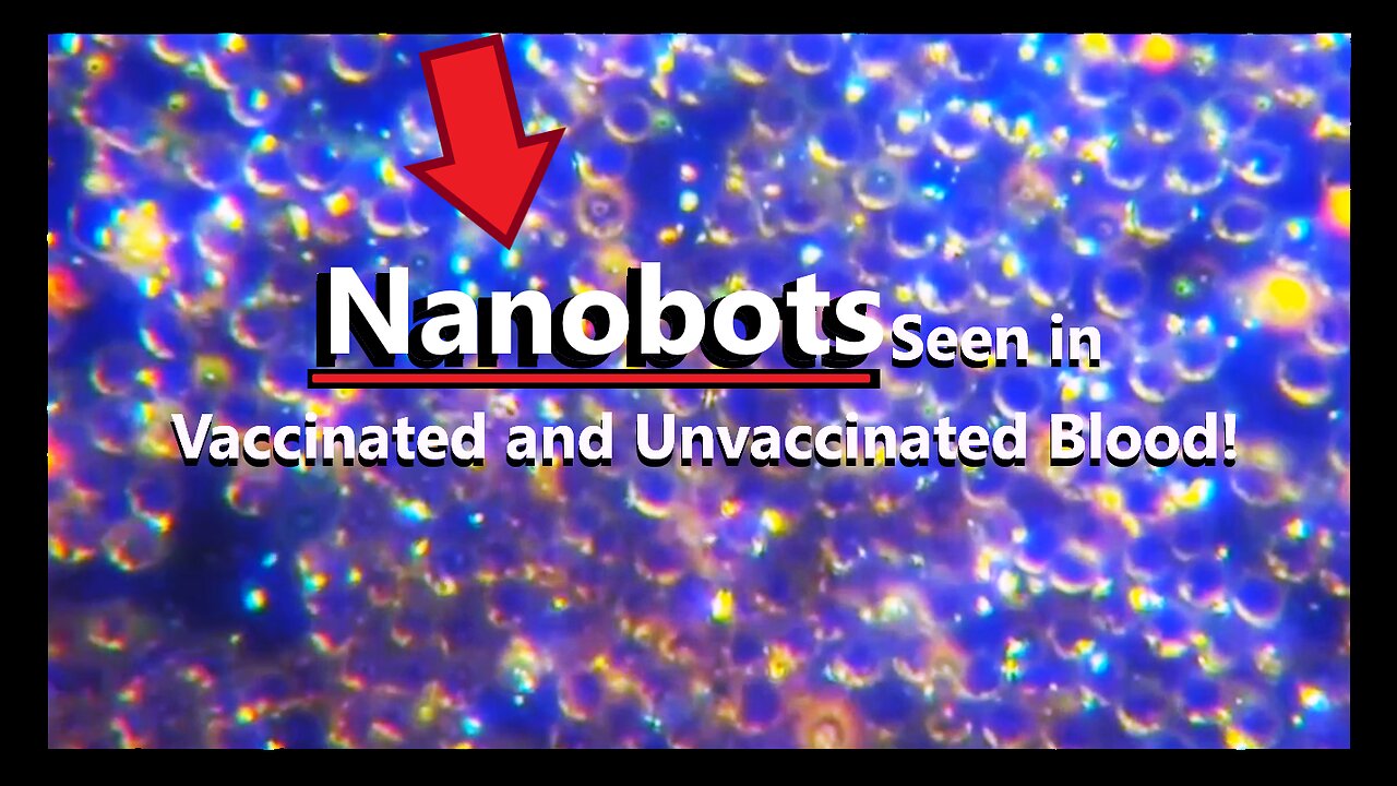 DR. ANA MIHALCEA SAYS NANOBOTS FOUND IN VACCINATED & UNVACCINATED!