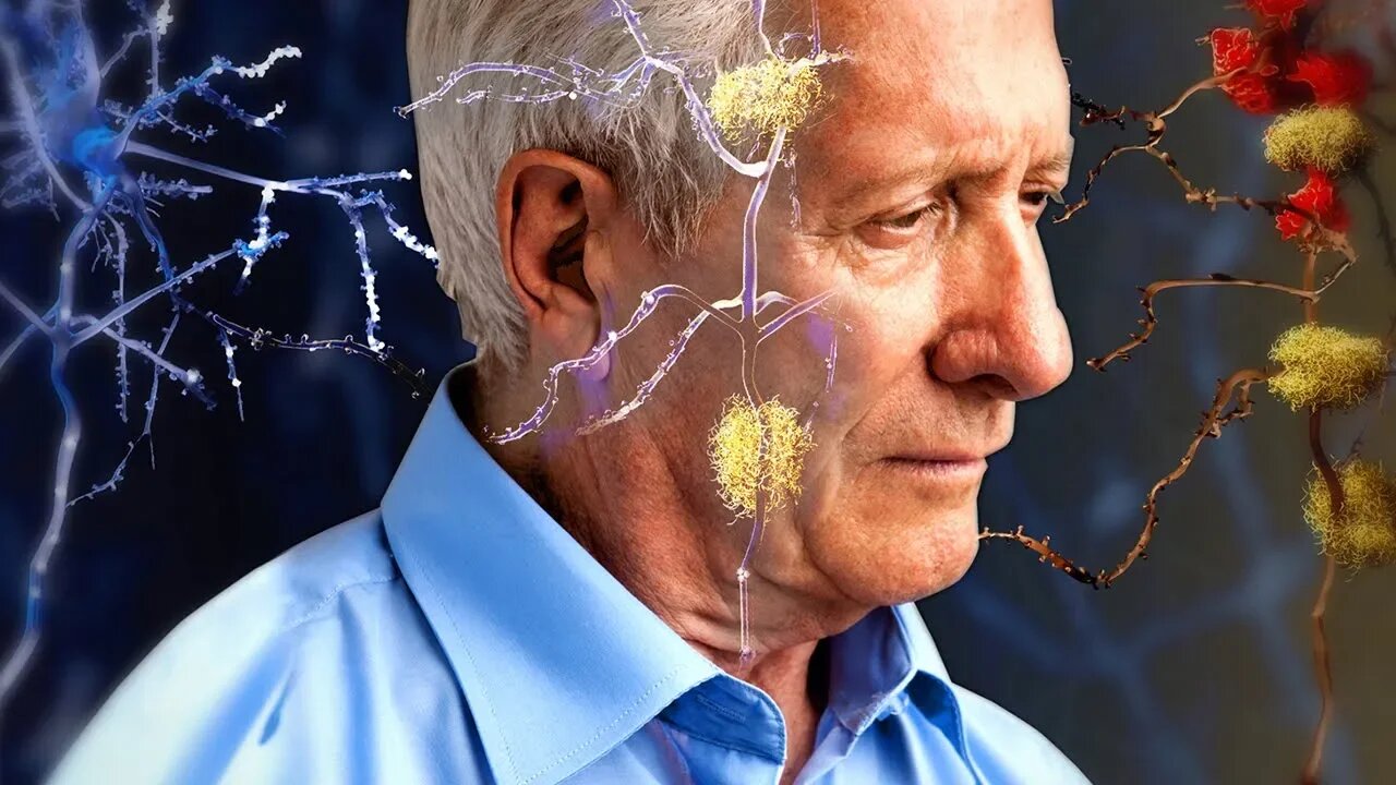 Alzheimer's or Forgetfulness? How to Tell the Difference