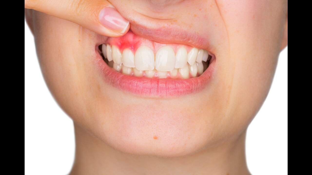 Get rid of tooth Decay and receding gums