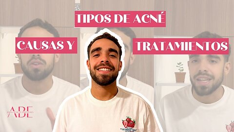 TIPOS DE ACNE DE LA A A LA Z - ¿CUÁL TIENES Y CÓMO TRATARLO RÁPIDO?