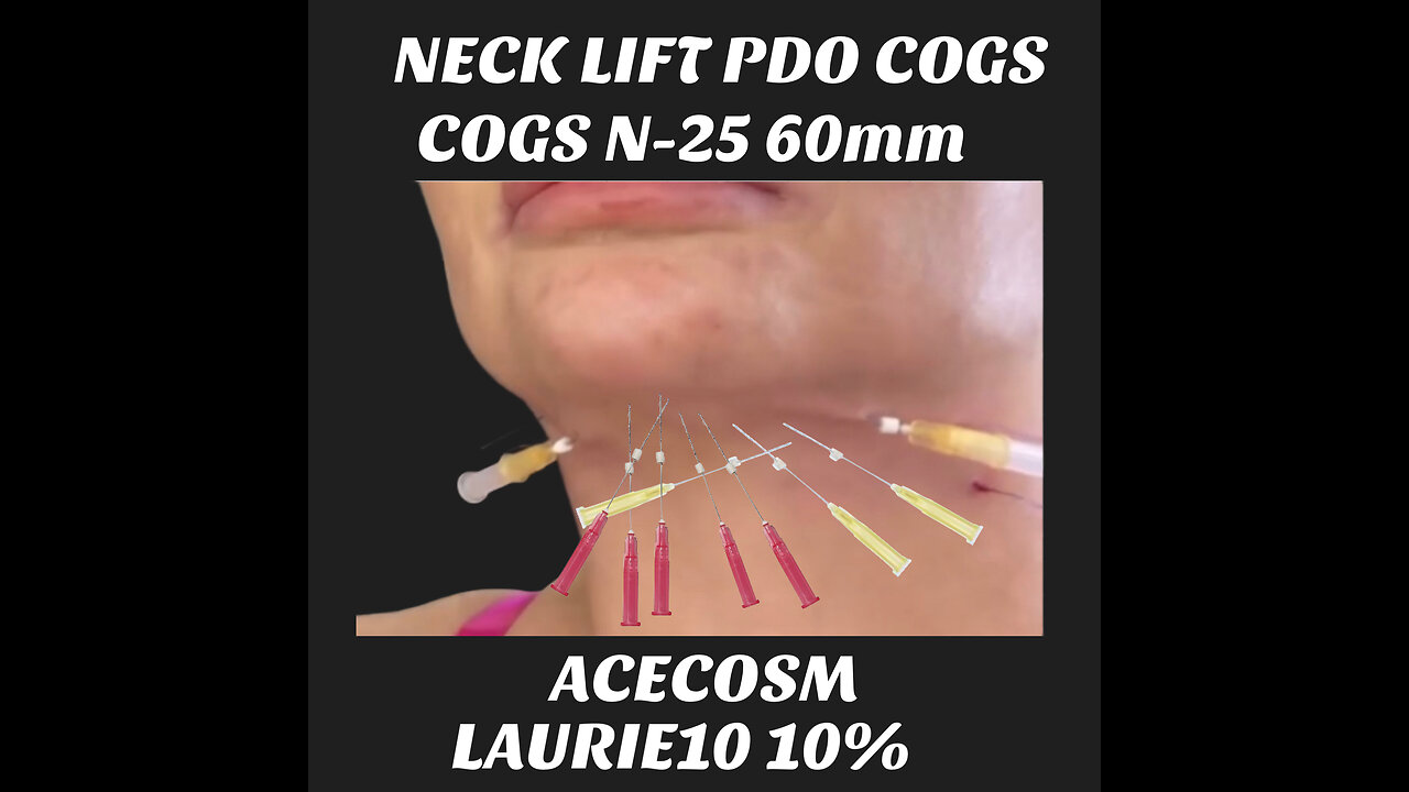 Instant Neck Lift With Cogs N25